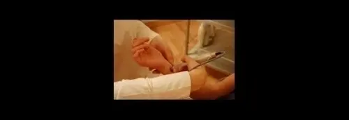 arret du tabac avec la luxopuncture