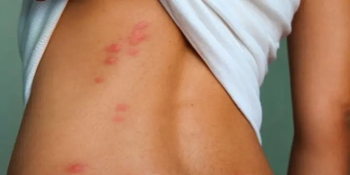 Désinsectisation, dératisations et désinfection