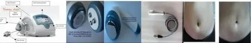 Cavitation RF Slimming system with four  à Beijing