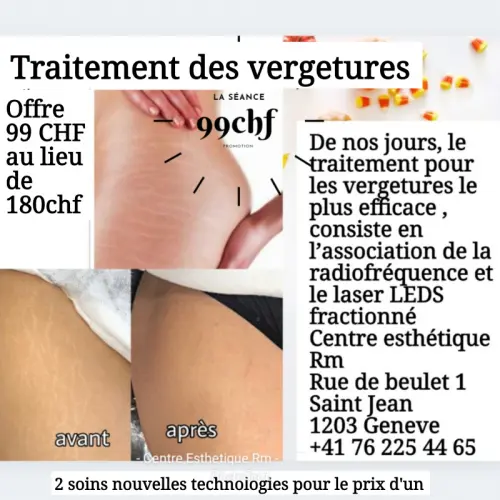 Traitement des vergetures à Genève