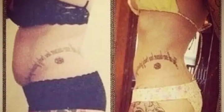 Rajeunir votre tatouage,tattoo= possible