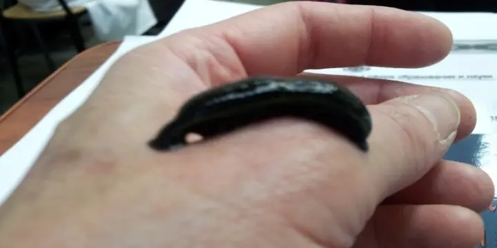 Hirudothérapie Massages Nutrition Sangsu