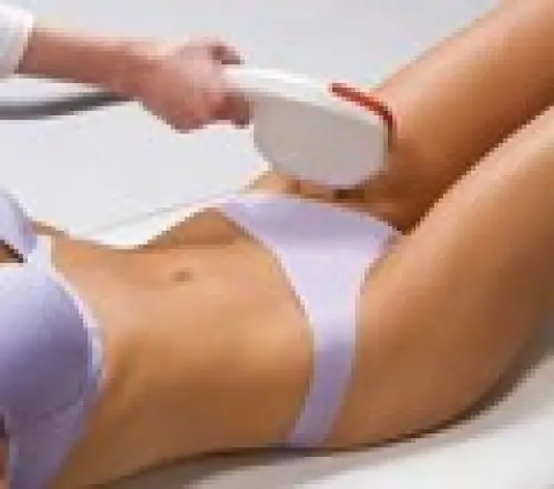 Epilation définitive à lumière pulsée à Chavannes-près-Renens