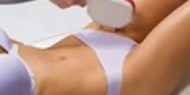 Epilation définitive à lumière pulsée