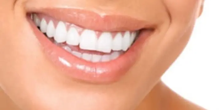 Offrez-vous un sourire de rêve!!!