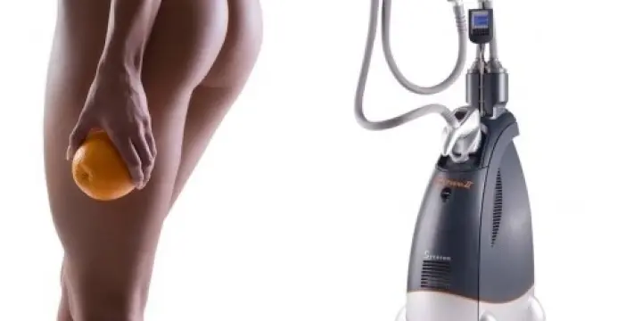VelaShape, la solution anti-cellulite