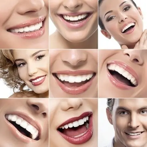 Bar à sourire Naturalsmile à Montreux