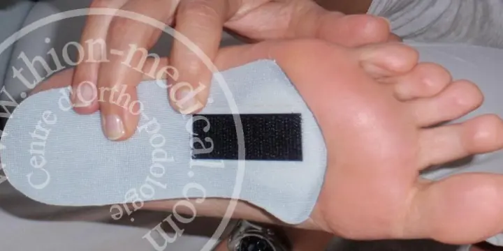 Semelles METASTAR pour douleurs médianes